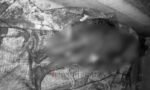 BREAKING NEWS: Warga Randan Batu Meninggal Dunia Tertimbun Longsor