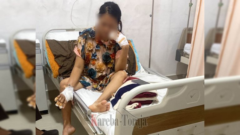 Kondisi Ibu yang Dib*cok Anaknya di Makale Semakin Membaik